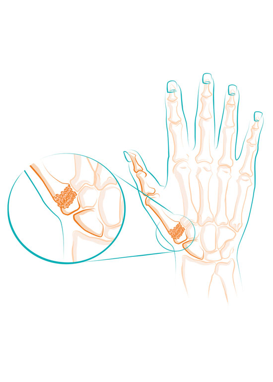 Illustration anatomique du squelette de la main.