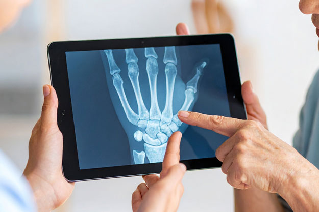Analyse d'une radiographie de la main sur tablette.