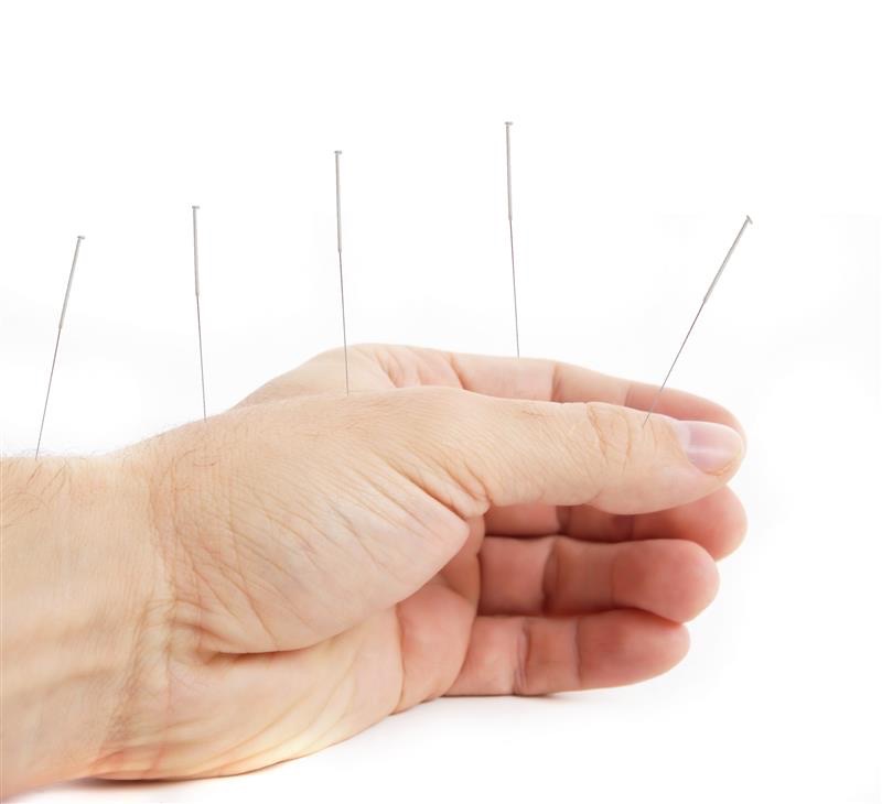 Aiguille d'acupuncture insérée dans la main.
