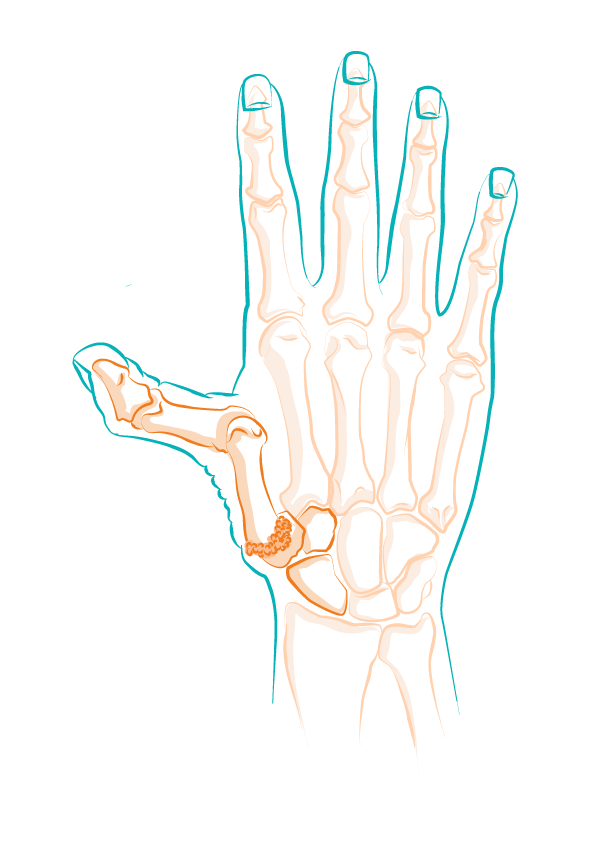 Schéma d'un squelette de main en détail.