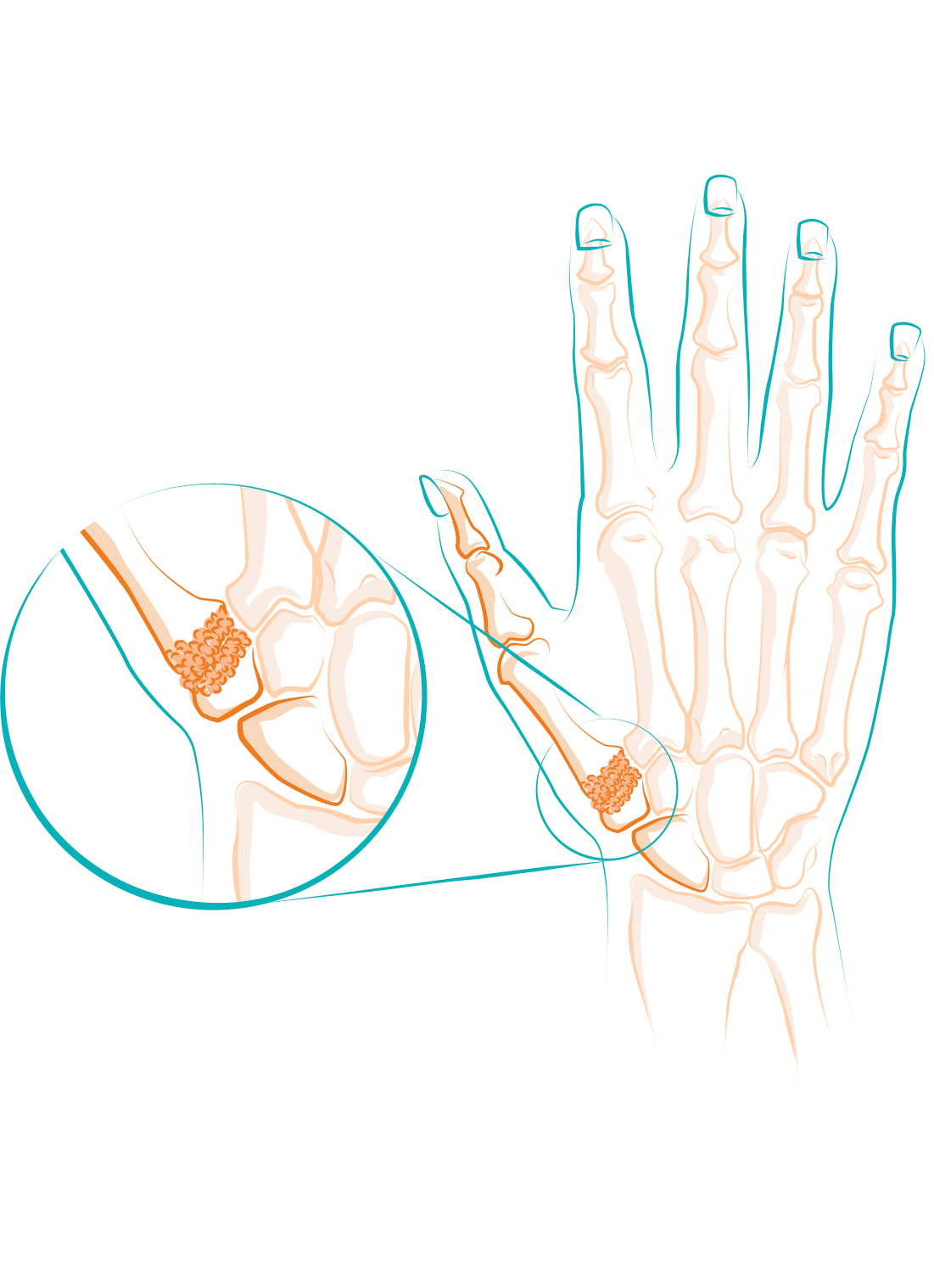 Schéma des os de la main et articulation.