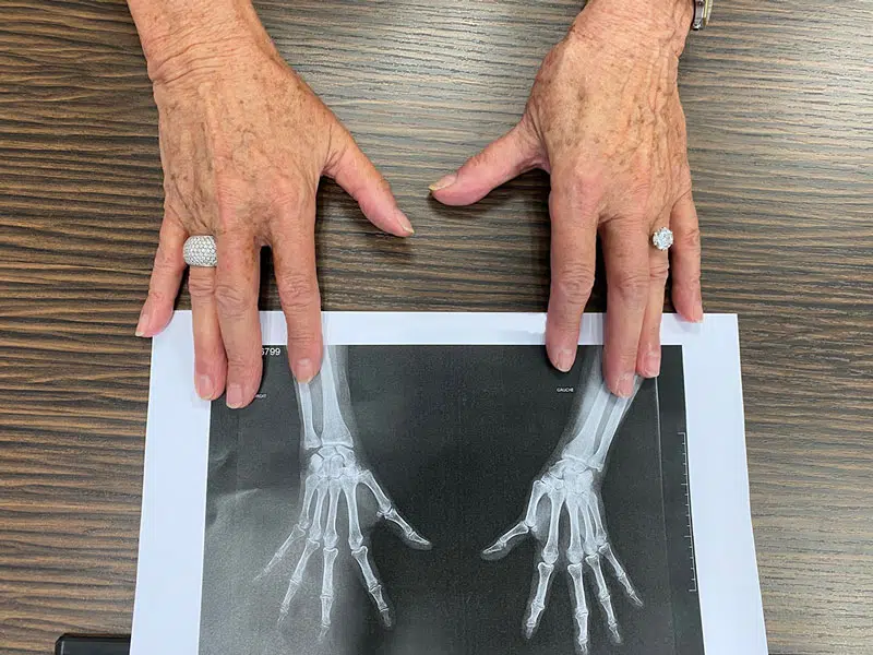 Mains tenant une radiographie des os des mains