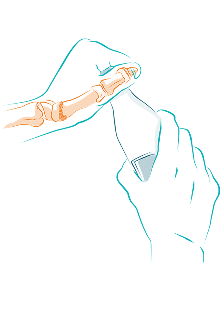 Schema dat het ongemak en de pijn bij het openen van een fles illustreert